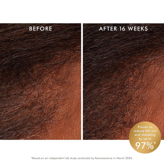 Moroccanoil Revitalizing Scalp Tonic Treatment 3.4 Oz – Boosts Scalp Health