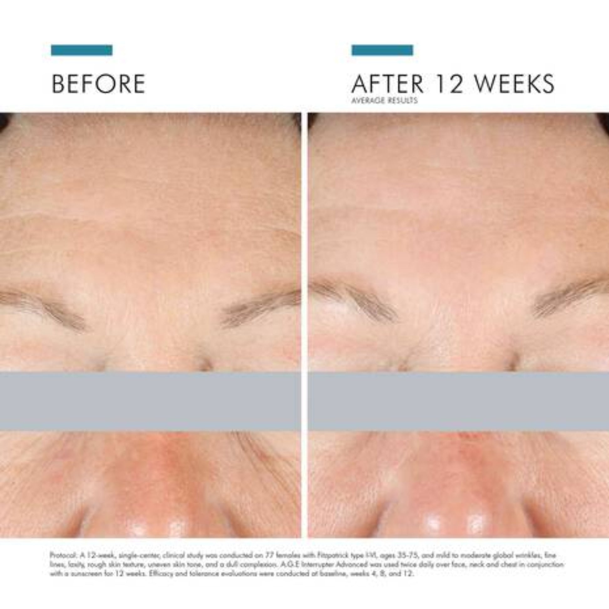 SkinCeuticals A.G.E. Interrupter Advanced Anti-Aging Cream