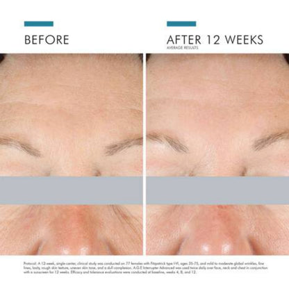 SkinCeuticals A.G.E. Interrupter Advanced Anti-Aging Cream