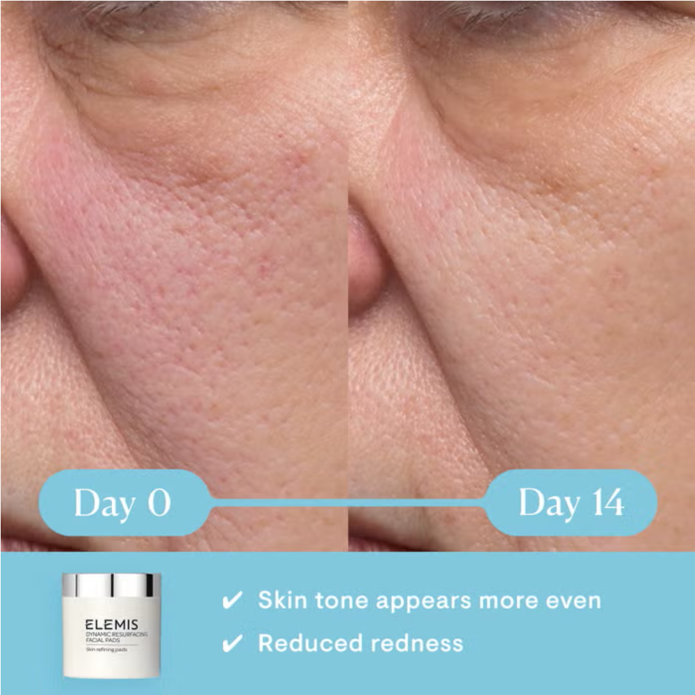 Elemis Dynamic Resurfacing Facial exfoliating pads for refined texture.