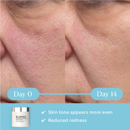 Elemis Dynamic Resurfacing Facial exfoliating pads for refined texture.