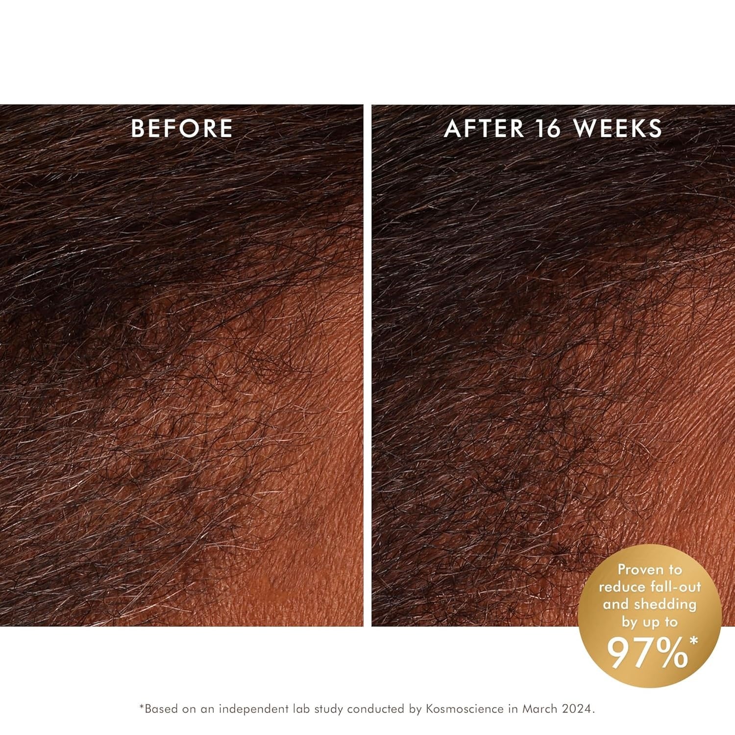 Moroccanoil Revitalizing Scalp Tonic Treatment 3.4 Oz – Boosts Scalp Health