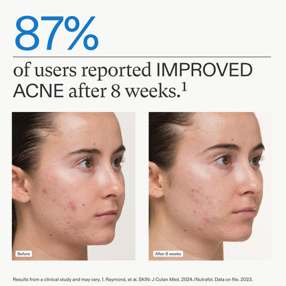 Nutrafol Clear Skin Supplement 3-Month Supply – supports acne-free skin