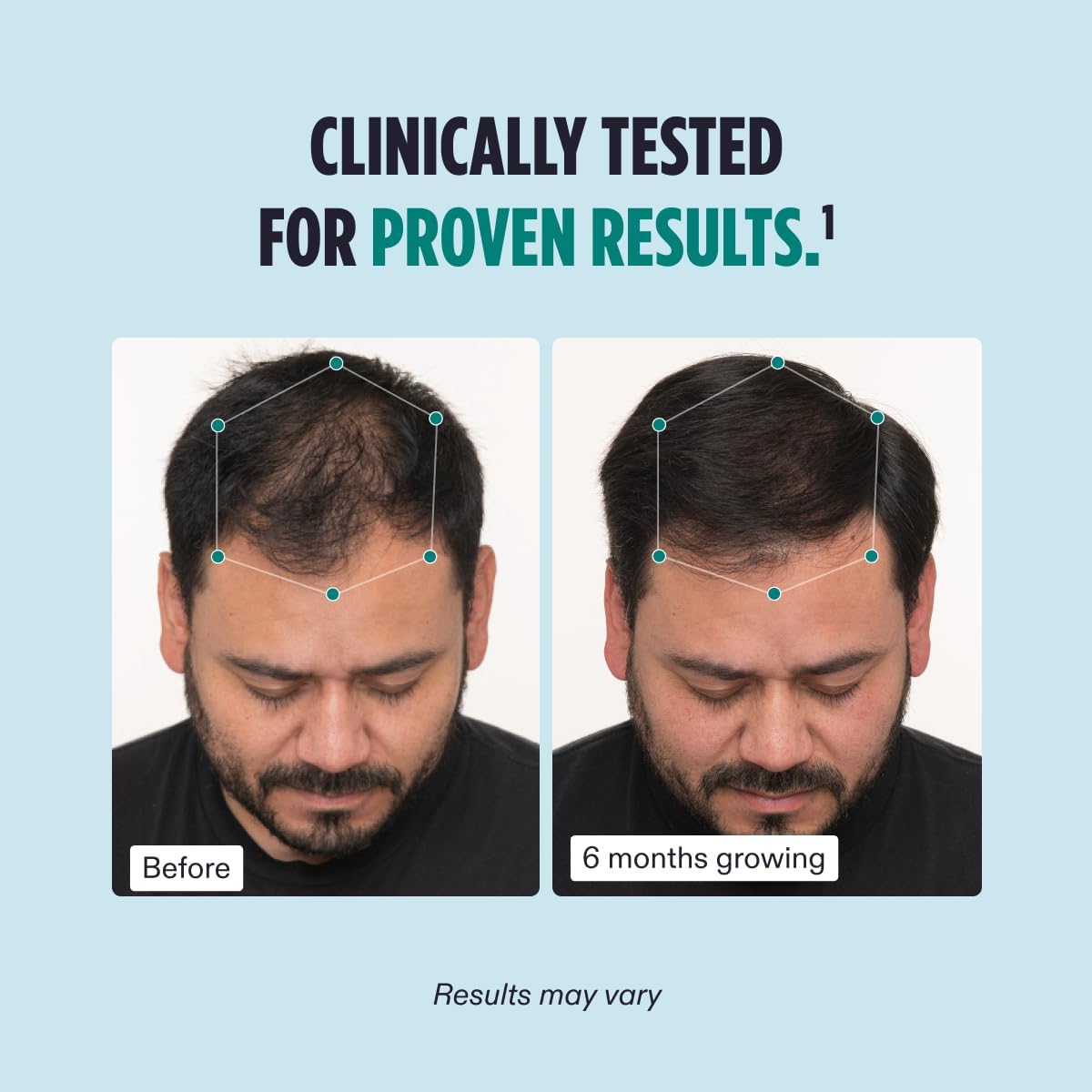Nutrafol Men’s Hair Growth Supplement 3-Month Supply – advanced formula for stronger, fuller hair