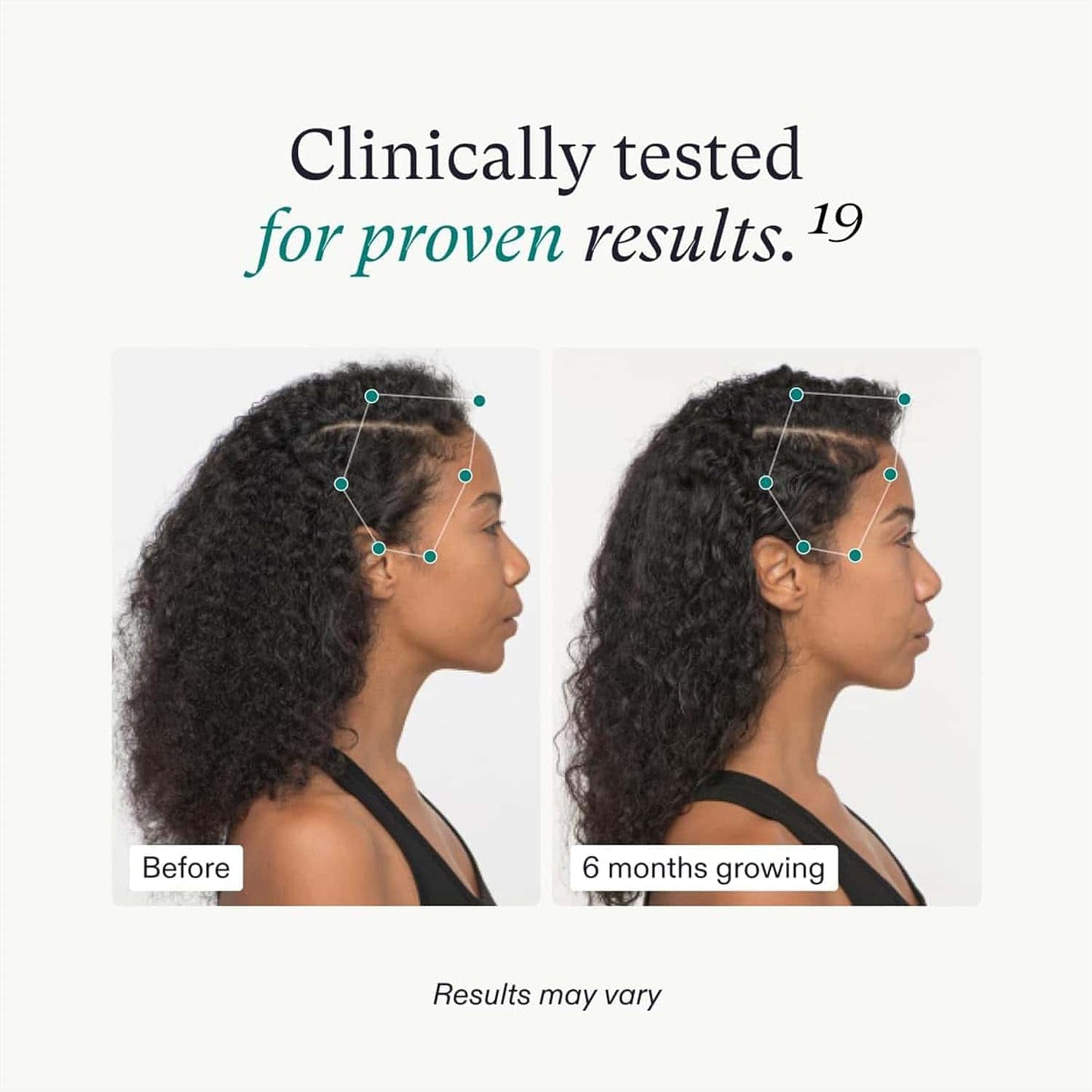 Nutrafol Women’s Vegan Hair Growth Supplement Pack – natural, vegan hair growth formula