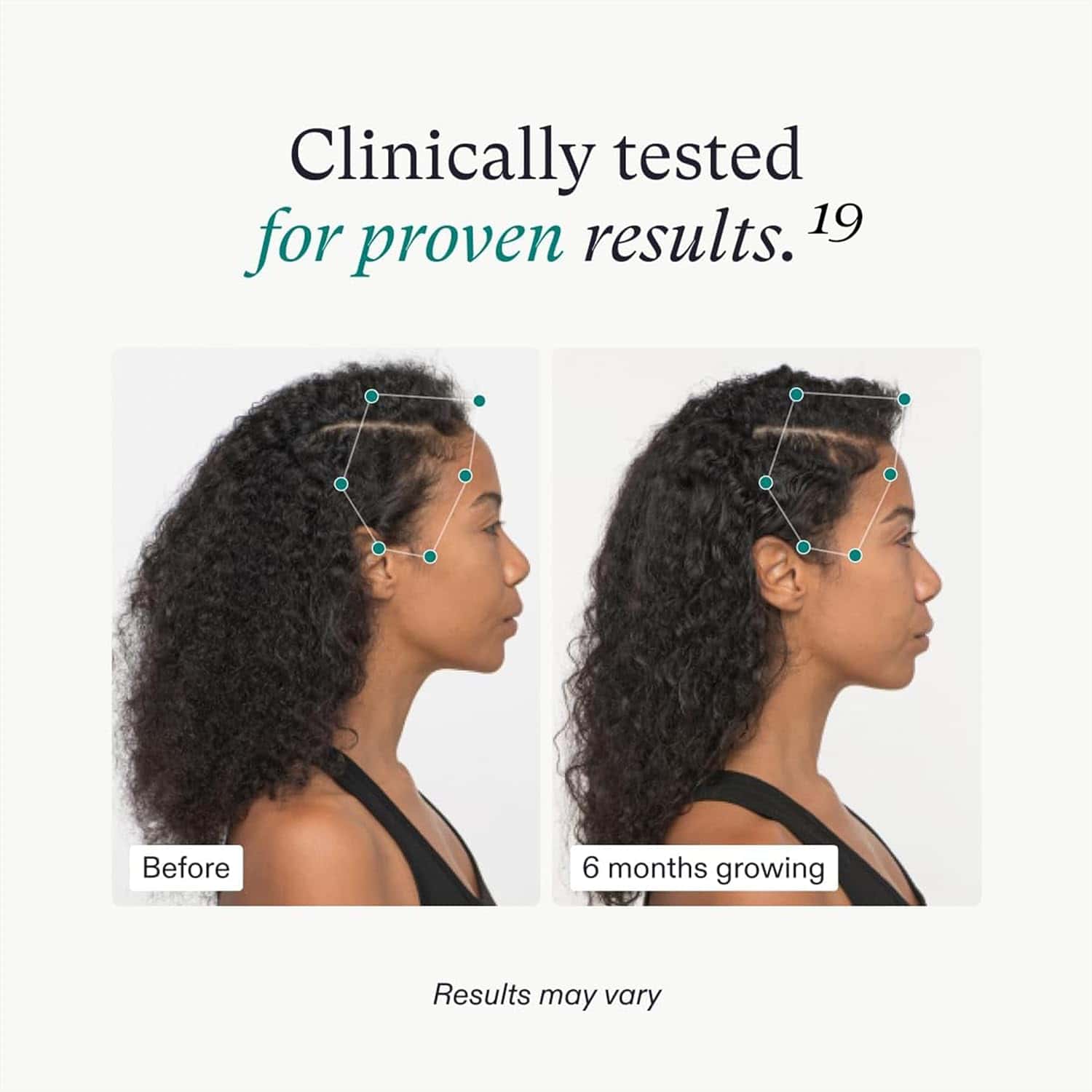 Nutrafol Women’s Vegan Hair Growth Supplement Pack – natural, vegan hair growth formula