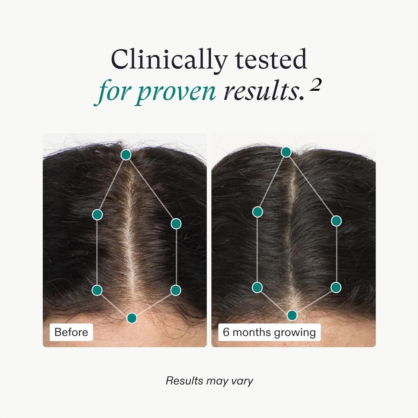 Nutrafol Women’s Hair Growth 3-Month Supply – supports healthy hair growth