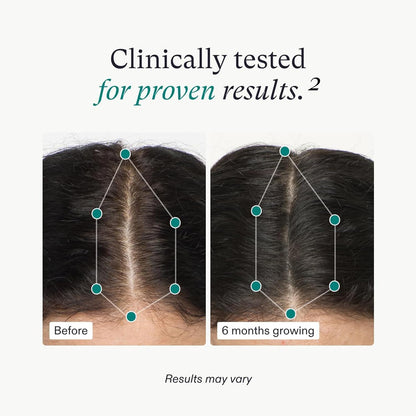 Nutrafol Women’s Hair Growth 3-Month Supply – supports healthy hair growth
