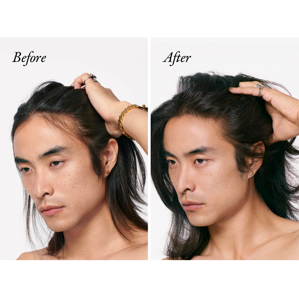 Oribe Serene Scalp Densifying Treatment Spray for thicker, healthier scalp and hair.